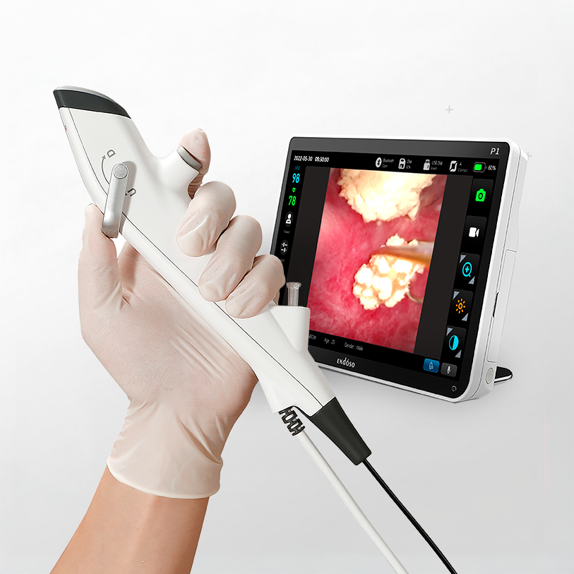 Ureteroscopio flexible descartable Endoso